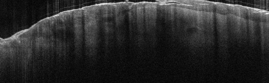 P_VA109_S_800_24-Apr-2012_10.18.07_OCT_Scan