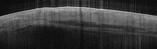 P_VA109_S_804_24-Apr-2012_10.19.27_OCT_NA