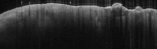 P_VA111_S_809_24-Apr-2012_10.23.03_OCT_Scan