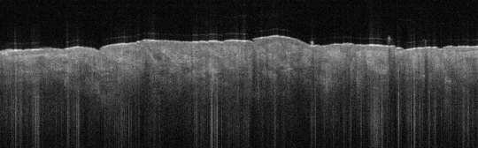 P_VA115_S_838_24-Apr-2012_11.42.48_OCT_NA