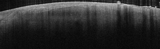 P_VA117_S_843_27-Apr-2012_11.02.45_OCT_Scan