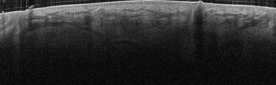 P_VA117_S_846_27-Apr-2012_11.04.32_OCT_NA