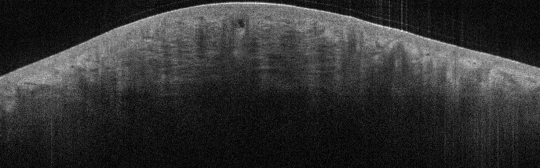 P_VA118_S_848_27-Apr-2012_11.39.09_OCT_Scan