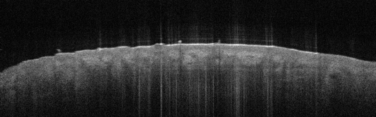 P_VA118_S_851_27-Apr-2012_11.40.33_OCT_NA