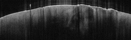 P_VA129_S_903_07-May-2012_15.14.48_OCT_Scan