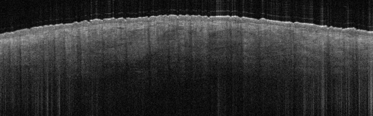 P_VA150_S_1022_22-May-2012_09.31.36_OCT_NA