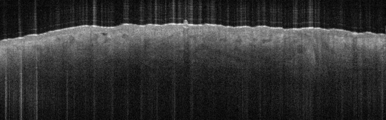 P_VA155_S_1046_22-May-2012_10.57.21_OCT_NA