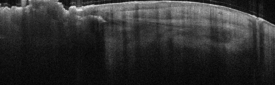 P_VA15_S_229_23-Jan-2012_14.10.45_OCT_R_Dorsal_Hand