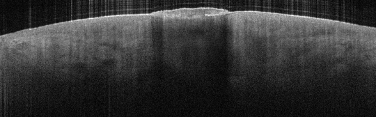 P_VA183_S_1191_25-Jun-2012_13.56.12_OCT_Scan