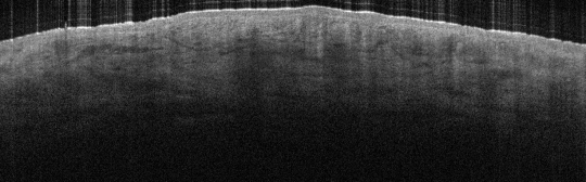 P_VA183_S_1196_25-Jun-2012_13.59.01_OCT_NA