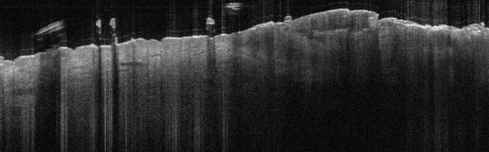 P_VA1_S_171_17-Jan-2012_09.47.39_OCT_Scan.2