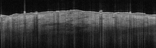 P_VA1_S_266_27-Jan-2012_08.13.48_OCT_Normal_R_Arm_