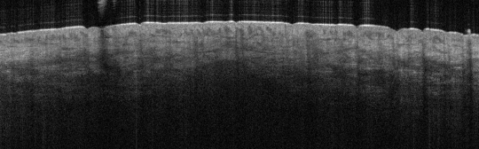 P_VA200_S_1322_03-Jul-2012_11.25.02_OCT_Scan.1