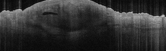 P_VA207_S_1380_10-Jul-2012_09.46.35_OCT_Scan