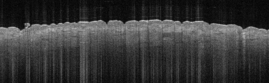 P_VA207_S_1385_10-Jul-2012_09.50.53_OCT_NA