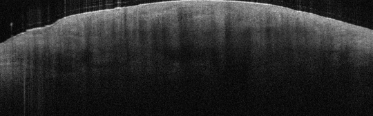 P_VA28_S_282_27-Jan-2012_10.47.59_OCT_R_Lateral_Arm_9-3