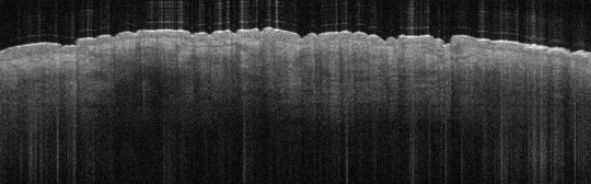 P_VA28_S_286_27-Jan-2012_10.49.46_OCT_Norml_L_Lateral_Arm