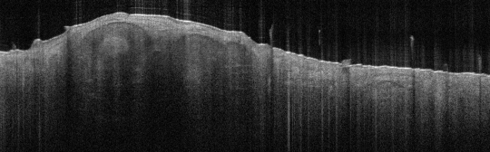 P_VA33_S_318_21-Feb-2012_08.26.17_OCT_Scan.1