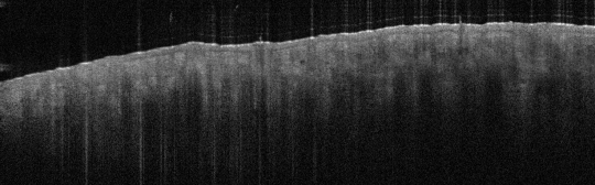 P_VA33_S_321_21-Feb-2012_08.27.45_OCT_NORMAL_BILATERAL