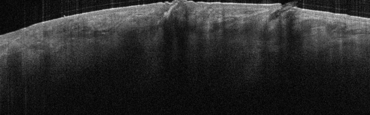 P_VA34_S_324_21-Feb-2012_08.49.10_OCT_NORMAL_ADJACENT