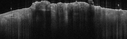 P_VA35_S_325_21-Feb-2012_08.50.35_OCT_Scan