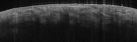 P_VA35_S_328_21-Feb-2012_08.51.45_OCT_NORMAL_ADJACENT