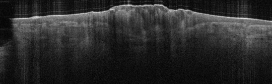 P_VA38_S_338_21-Feb-2012_09.31.23_OCT_Scan