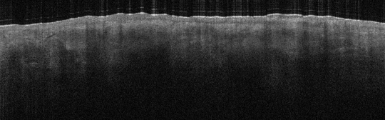 P_VA38_S_340_21-Feb-2012_09.32.12_OCT_NORMAL_ADJACENT