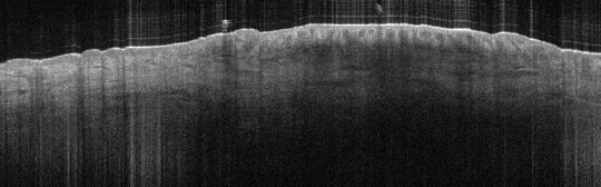 P_VA40_(b)_S_350_21-Feb-2012_10.55.42_OCT_Scan.1