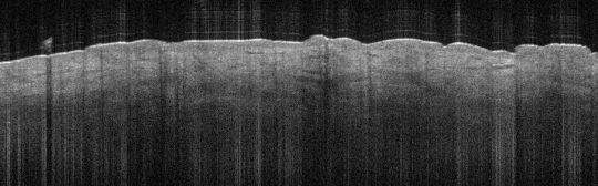 P_VA40_(b)_S_352_21-Feb-2012_10.56.25_OCT_NORMAL_ADJACENT