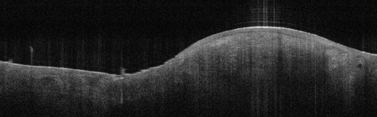 P_VA43_S_361_27-Feb-2012_15.30.46_OCT_Scan