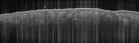 P_VA43_S_364_27-Feb-2012_15.32.07_OCT_NORMAL_ADJACENT