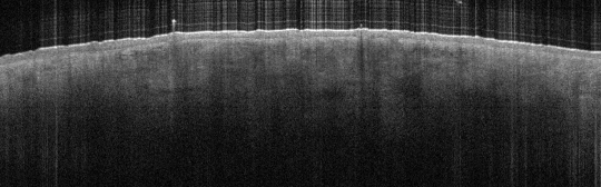 P_VA71_S_597_03-Apr-2012_11.19.14_OCT_NORMAL