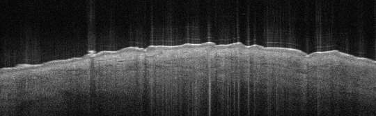 P_VA76_S_625_06-Apr-2012_08.58.50_OCT_NA