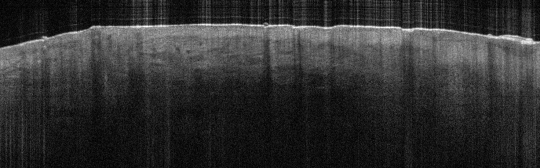 P_VA87_S_689_10-Apr-2012_11.36.44_OCT_Scan