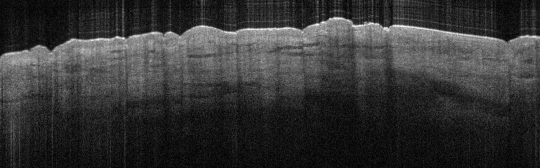 P_VA87_S_693_10-Apr-2012_11.37.58_OCT_NORMAL_ADJACENT