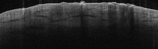 P_VA90_S_702_13-Apr-2012_09.16.32_OCT_Scan