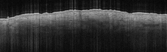 P_VA90_S_705_13-Apr-2012_09.17.35_OCT_NAS