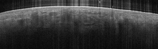 P_VA94_S_725_17-Apr-2012_10.01.42_OCT_NA