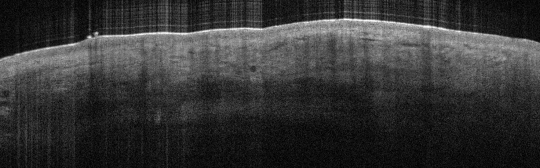 P_VA9_S_211_19-Jan-2012_15.47.31_OCT_Normal