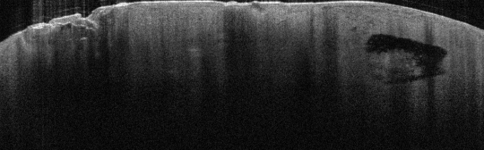 P_VA_54_S_430_01-Mar-2012_15.33.09_OCT_Scan.1