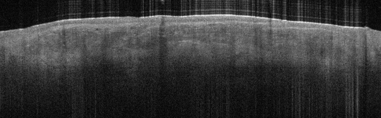 P_VA_54_S_435_01-Mar-2012_15.35.25_OCT_NORMAL_ADJACENT