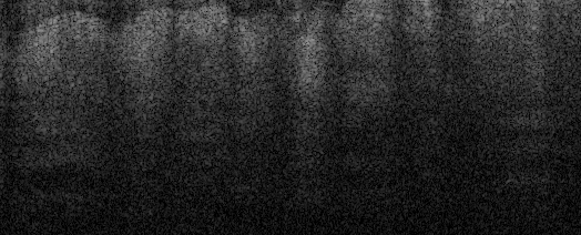 nepidermalkeratinocytes