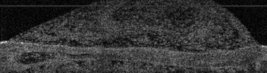fluidcelldebris